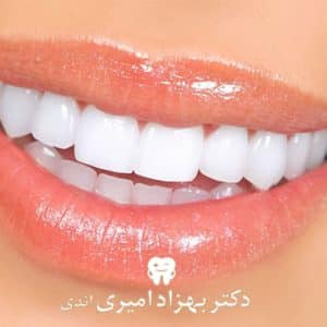 کامپوزیت دندان در مازندران