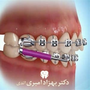 مراحل ارتودنسی