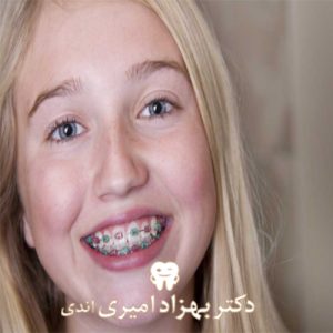 ارتودنسی و سیم کشی دندان در کودکان و نوجوانان