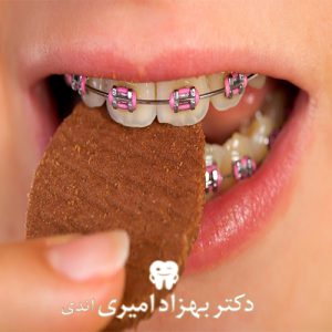 تغذیه مناسب در ارتودنسی