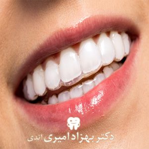 پلاک و نگهدارنده حین و بعد از ارتودنسی