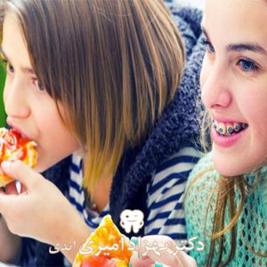 تغذیه مناسب در ارتودنسی