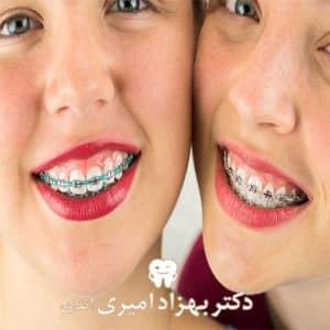 بهترین سن برای شروع درمان ارتودنسی