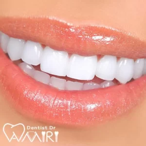 کامپوزیت دندان در مازندران