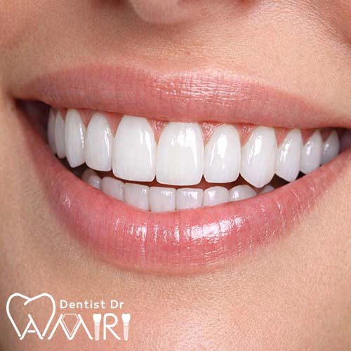 کامپوزیت دندان در بابل