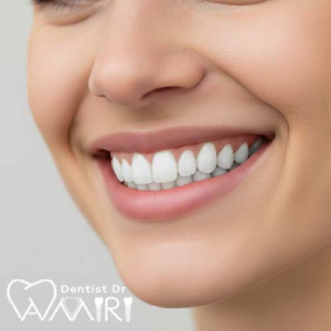 لبخند دندان با کامپوزیت ونیر در بابل – نمای مفهومی