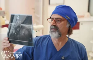 مراحل انجام ایمپلنت دندان