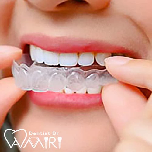 ارتودنسی متحرک