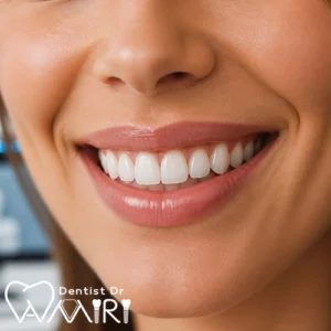 دندان&zwnj;های ترمیم شده با روکش و لمینت سرامیکی ای&zwnj;مکس (Emax)