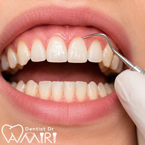 جراحی لثه در بابل توسط متخصص