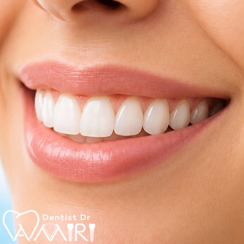 طراحی لبخند در بابل